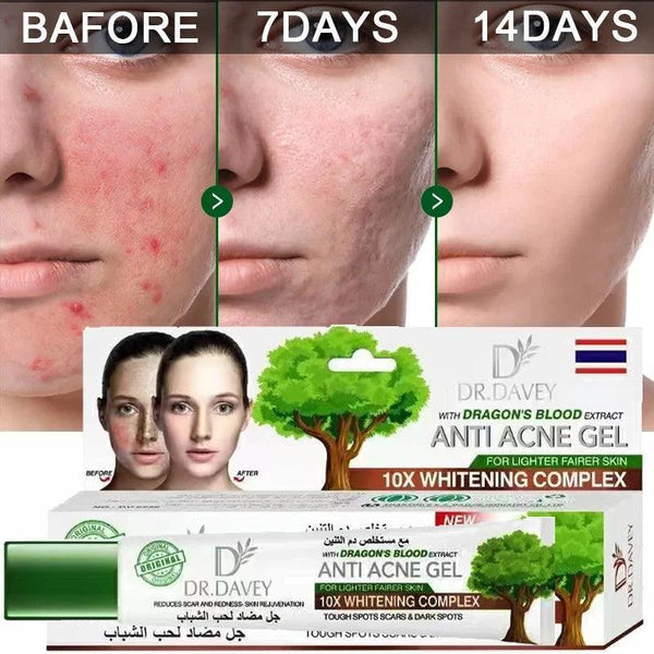 ANTI ACNE GEL Dr Davey