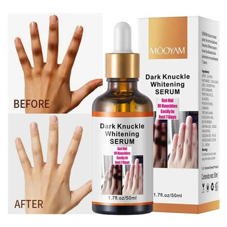 MOOYAM Dark knuckles whitening serum 50ml